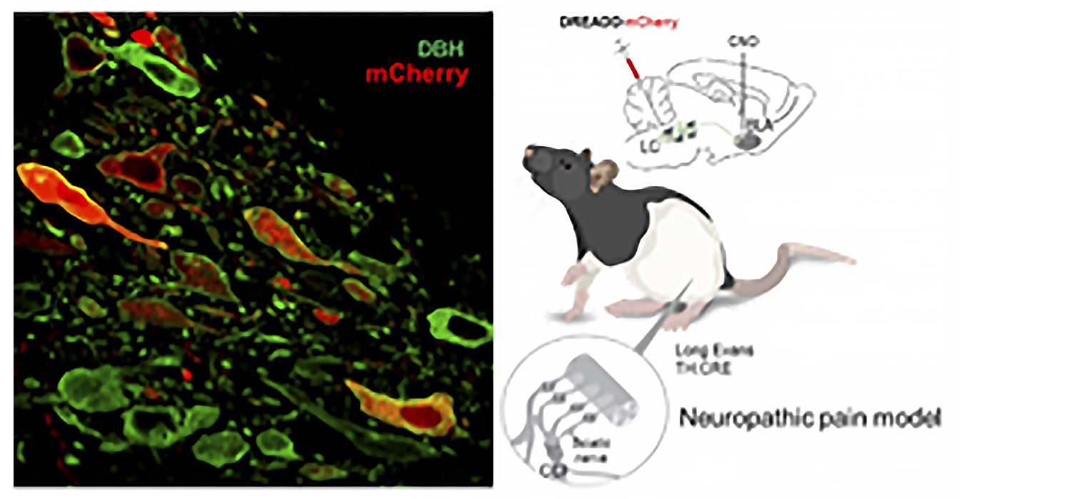 Identifican una conexión de neuronas en el cerebro que justificaría la ansiedad y los trastornos de memoria en pacientes con dolor crónico