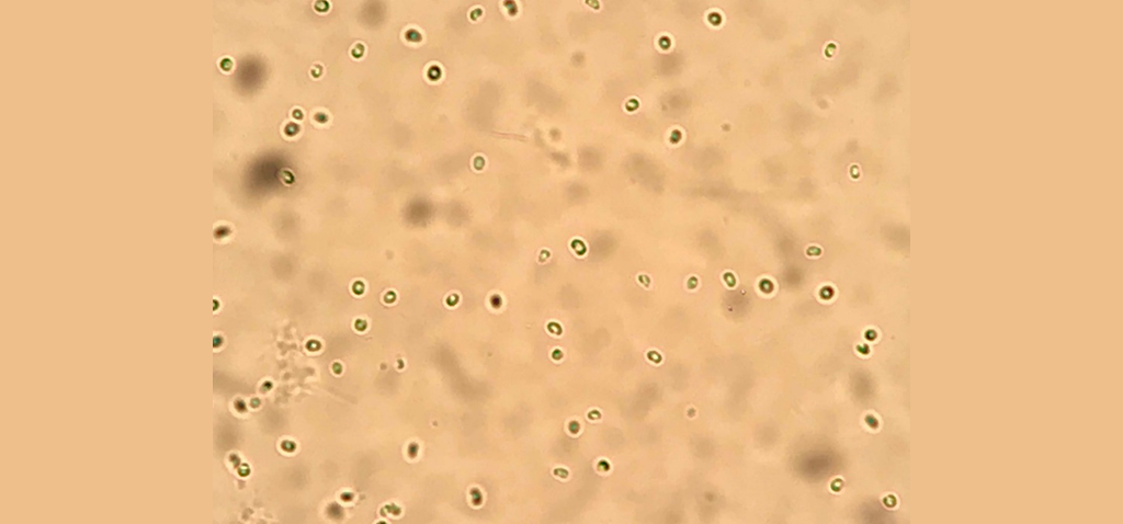 Investigadores de la UCA obtienen a partir de una microalga una proteína que inhibe el crecimiento tumoral